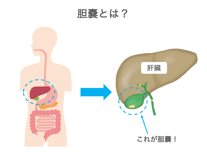 胆石症・胆嚢炎