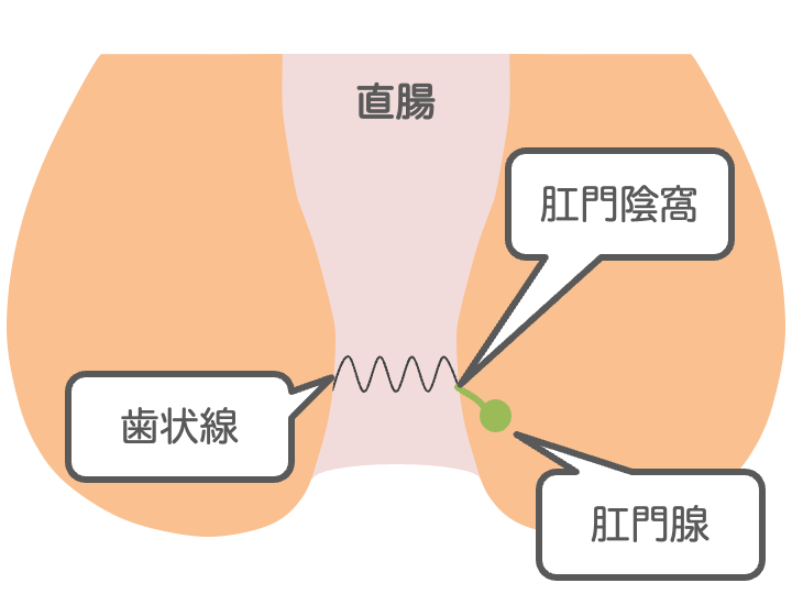 痔核（いぼ痔）とはのイメージ画像