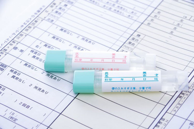 便潜血陽性とはのイメージ画像