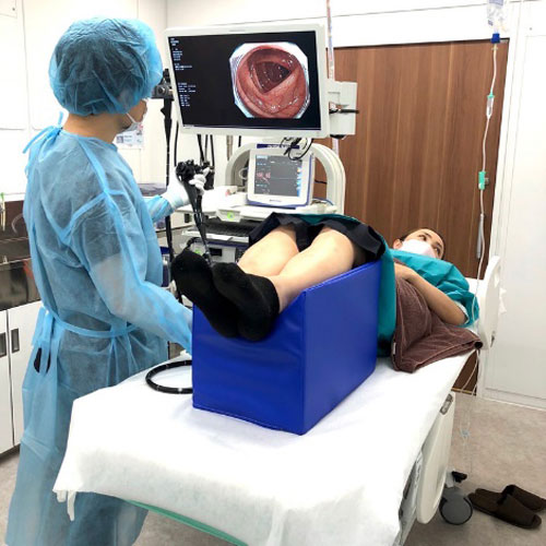 大腸内視鏡検査のイメージ画像