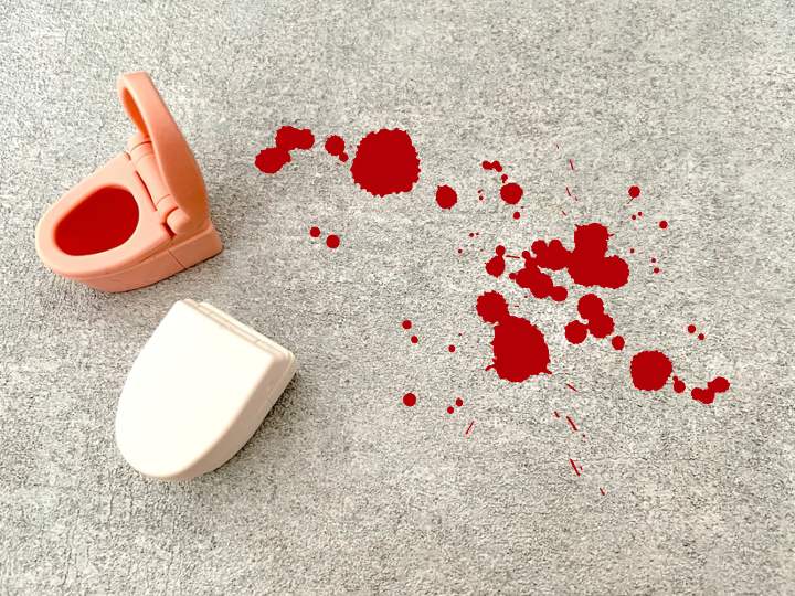 血便と下血の違い画像のイメージ画像