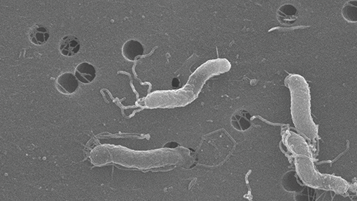 【ピロリ菌の電子顕微症画像】（ヤクルト中央研究所HPより引用）