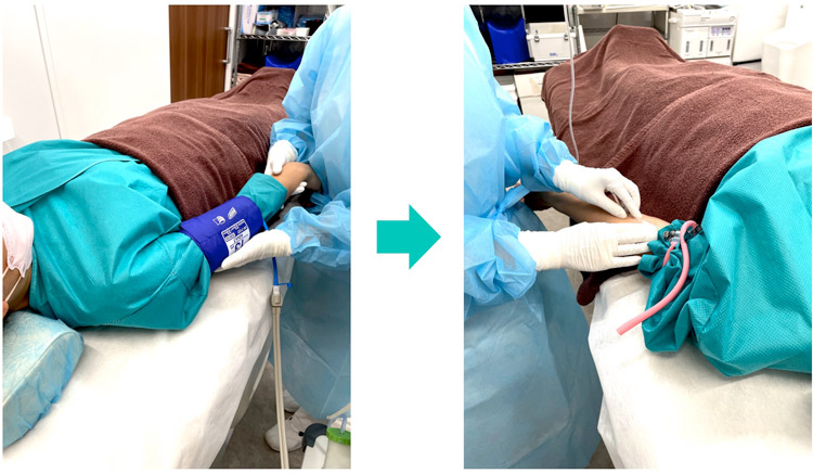 血圧測定・点滴ルート確保イメージ画像