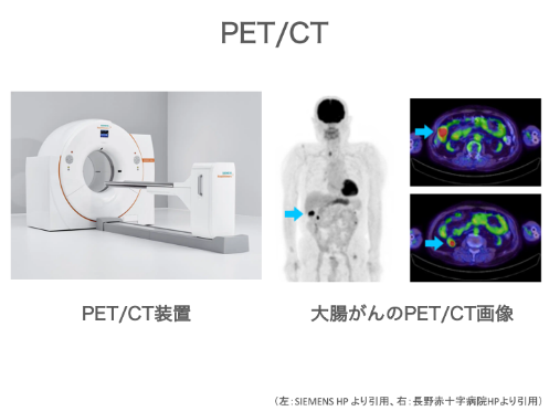 PET/CT検査のイメージ画像