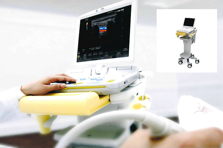 肛門エコーのイメージ画像